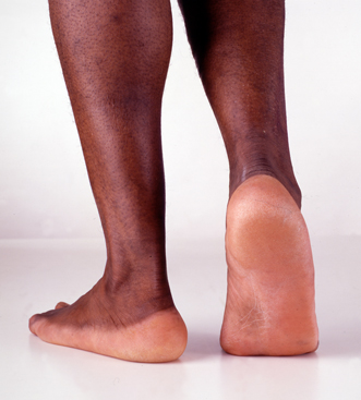 Image depicting Foot Health